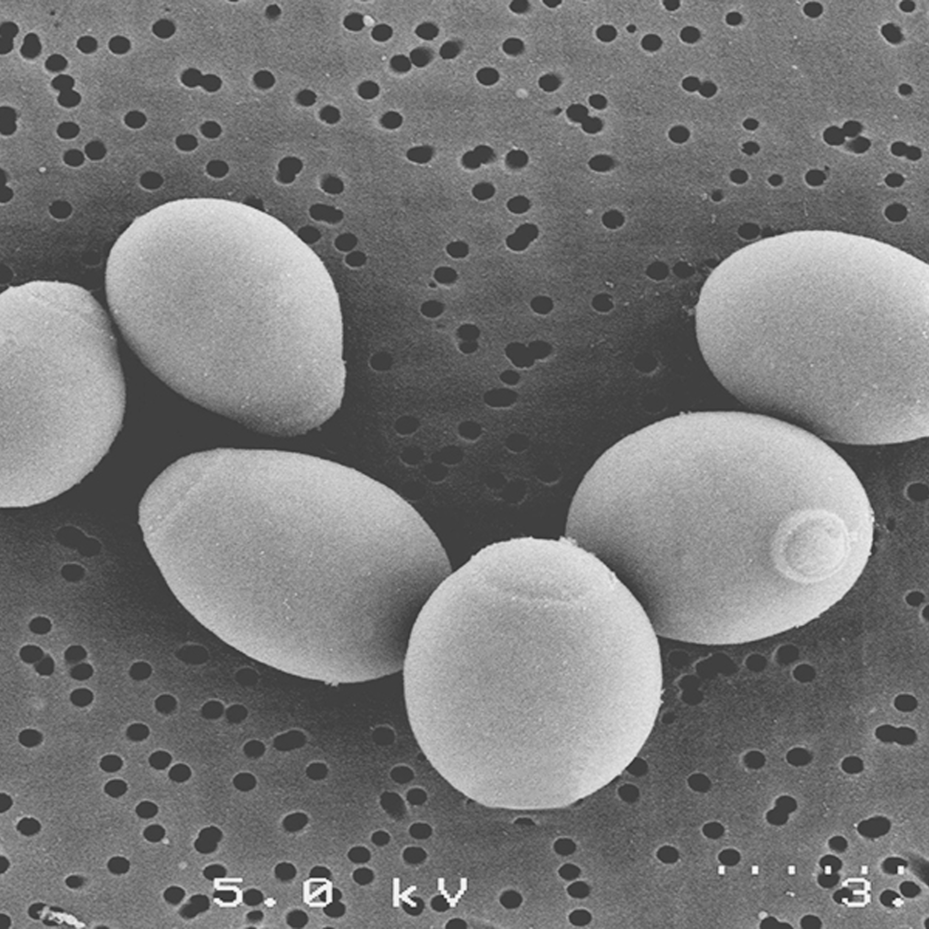 Saccharomyces