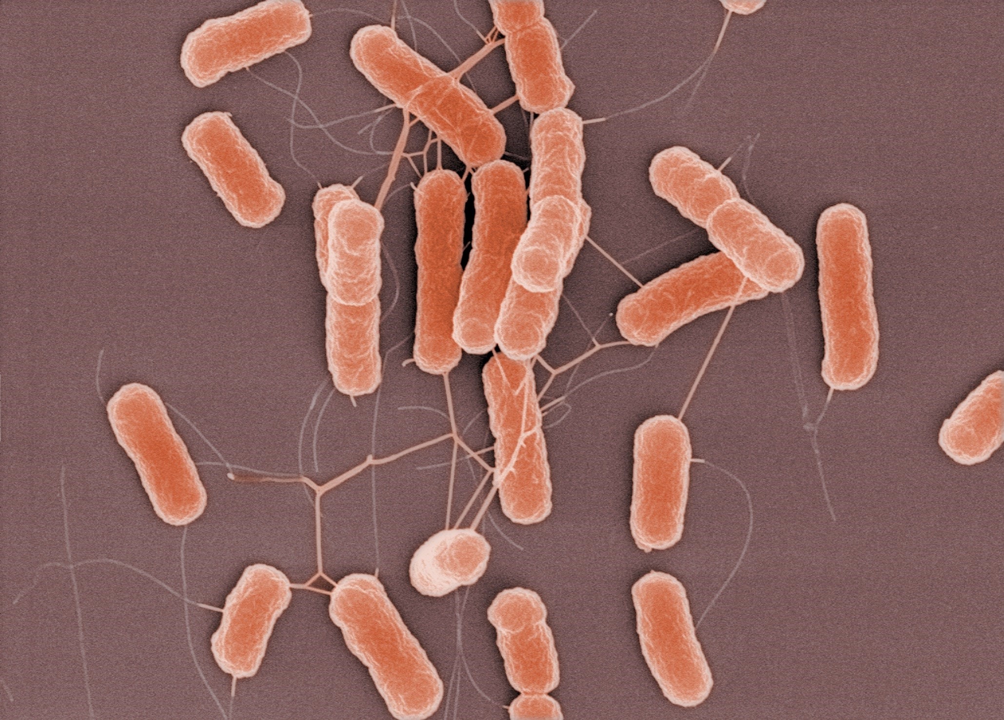 Photograph of E. coli