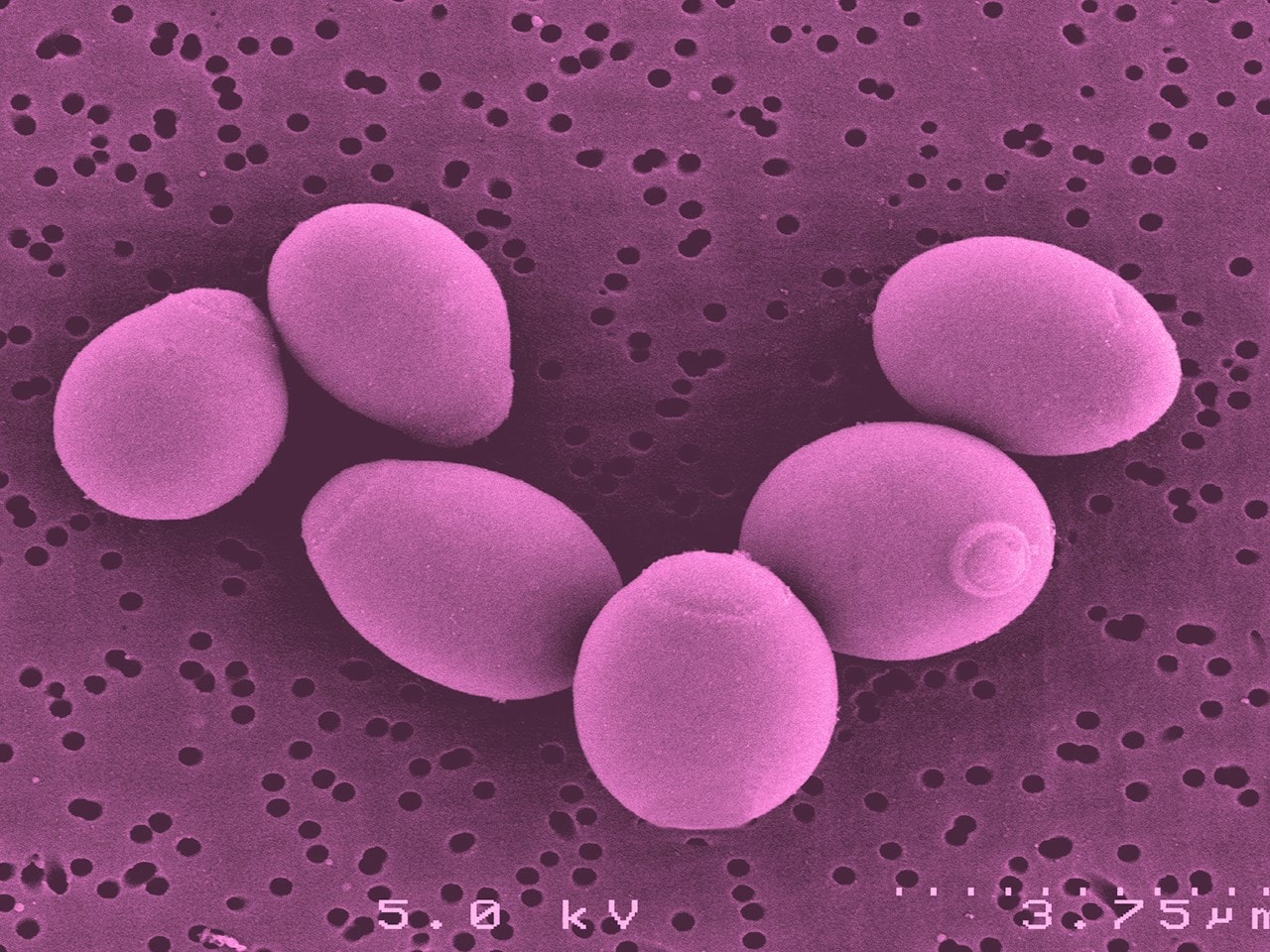 Saccharomyces boulardii bacteria