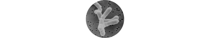 mikroskopisches Bifidobacterium infantis 35624