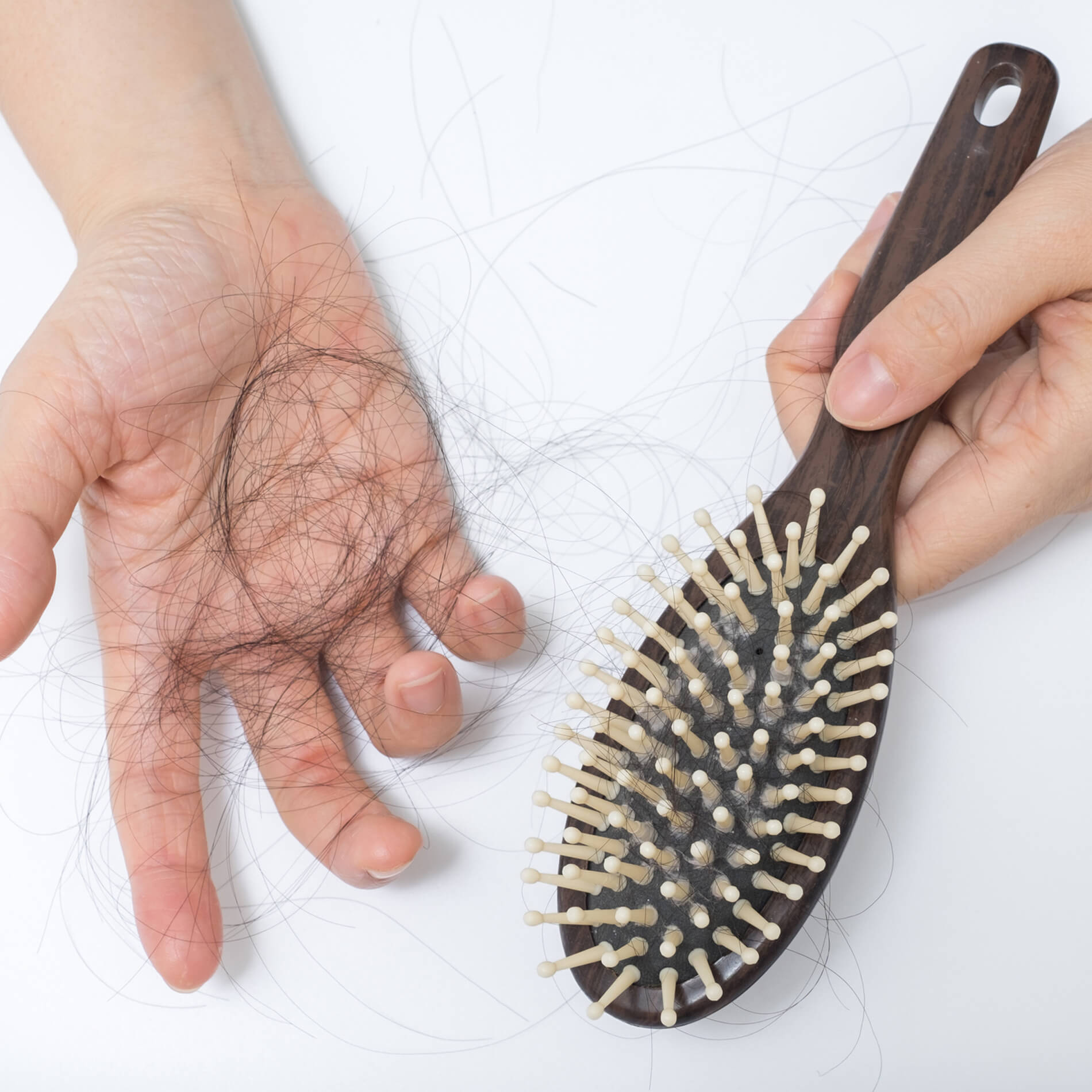 Surprising Link Between Alopecia & the Gut | Professionals Surprising Link Between Alopecia & the Gut | Professionals